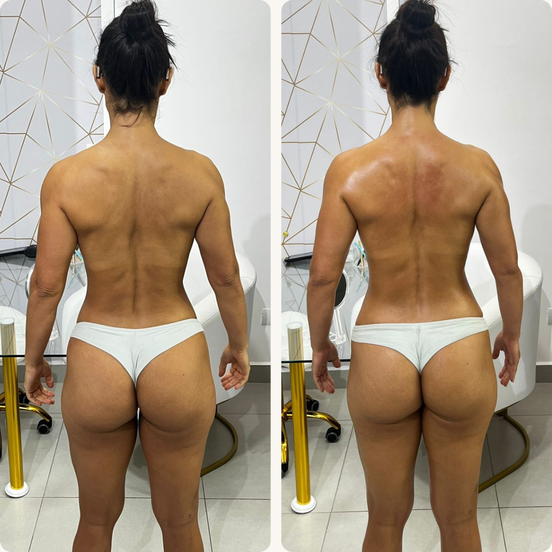 Antes e Depois - Terapia Capilar 1