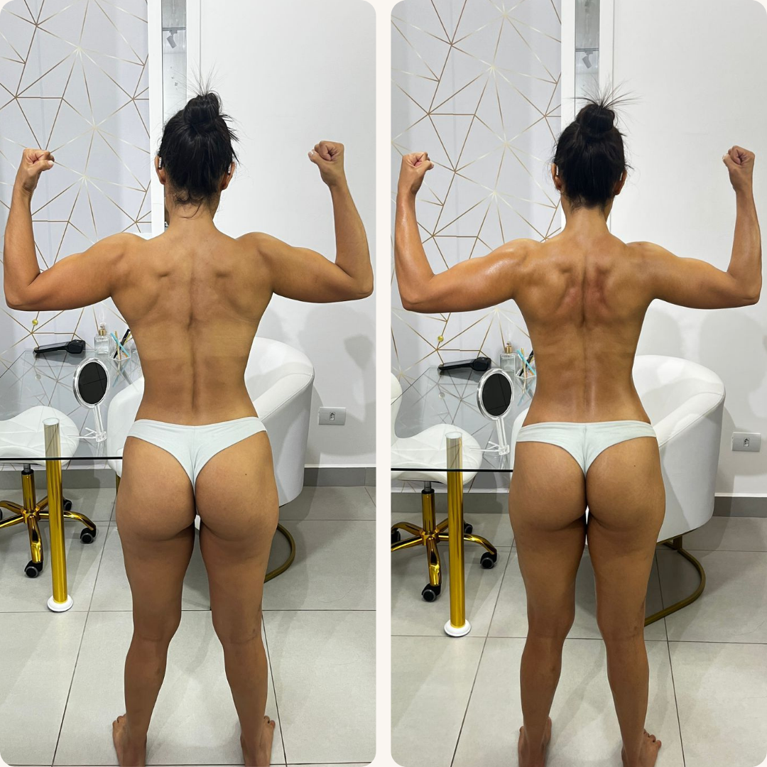 Antes e Depois - Terapia Capilar 2